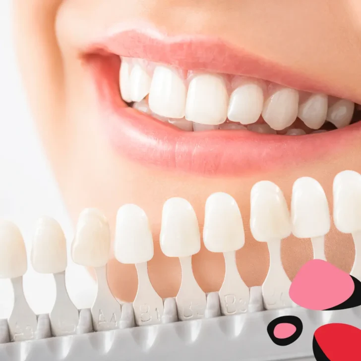 Transform Your Look: 7 Benefits of Professional Teeth Whitening