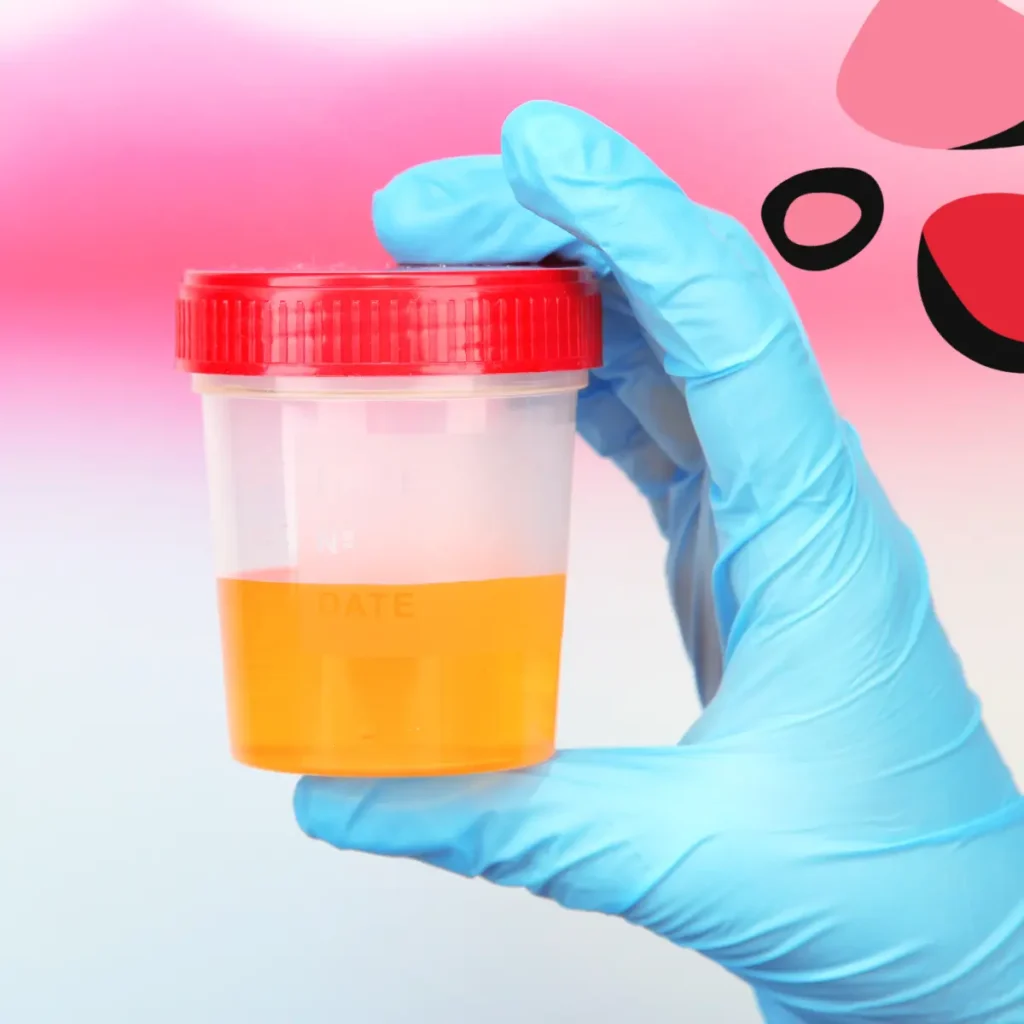 urine test
